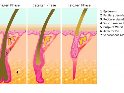 Hair Growth Cycle (A2) | Fleming Laser